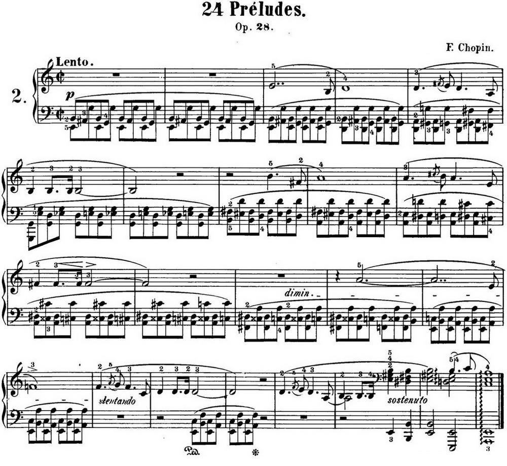 肖邦 24首钢琴前奏曲 Op.28 No.2 A小调钢琴曲谱（图1）